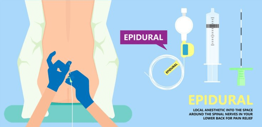bloqueio epidural possa tornar a paciente mais confortável, ainda é possivel que a mulher seja capaz de perceber as contrações, bem como sentir exames de toque durante a progressão do parto.